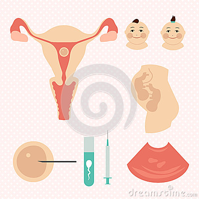 泰国的体外受精包括卵巢巧克力囊肿吗？